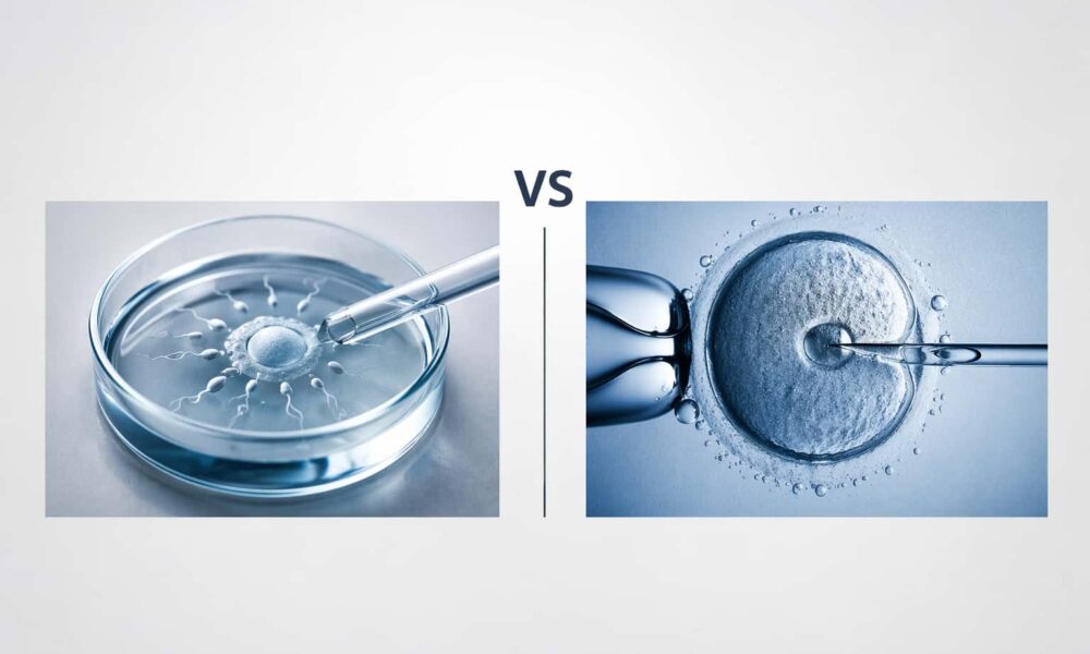 IVF vs ICSI comparison showing fertilization in a petri dish on one side and sperm injection into an egg on the other, separated by a central VS divider.