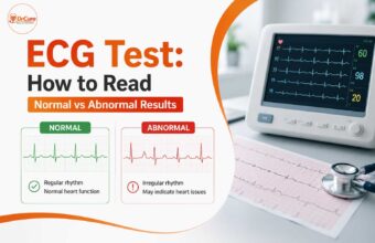 ecg test how to read